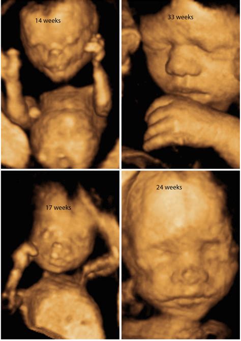 [最新] 24 weeks pregnant ultrasound 3d 214767-Can you get a 3d ultrasound at 24 weeks ...