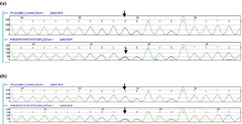 (a) The mutation in the RYR1 gene was confirmed by sequencing ...