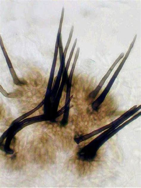 Colletotrichum - setose acervulus