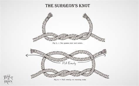 How to Tie a Surgeon’s Knot – Wolf & Iron