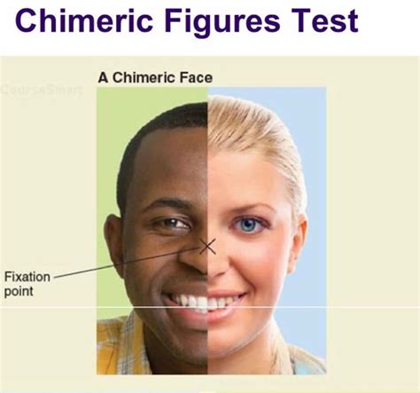 Split brain syndrome definition, causes, symptoms & experiments