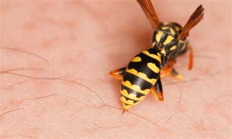 Are Wasp Stings Dangerous? (Our Warning!) | Pests Banned