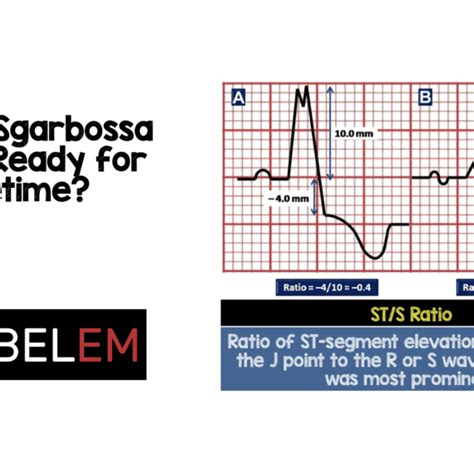 Modified Sgarbossa Criteria: Ready for Primetime? – MED-TAC ...