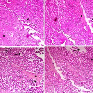 (PDF) Pathological and clinical investigations of an outbreak of Blackleg disease due to C ...