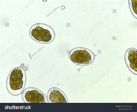 Necator Americanus Rhabditiform Larvae