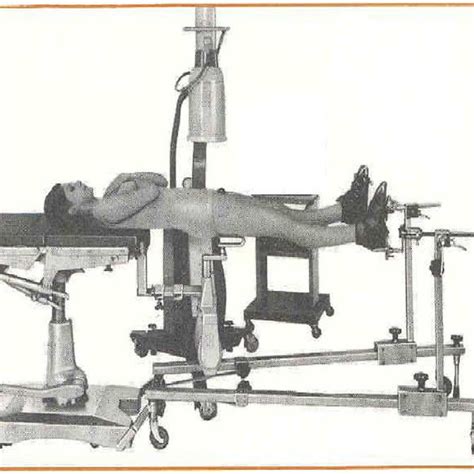 (PDF) Does the orthopedic fracture table cause urinary retention?