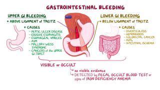 Esophageal Varices: What Are They, Causes, and More | Osmosis