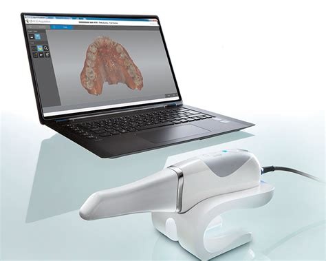 Clinica Dental Mater | Scanner Intraoral en Dental Master