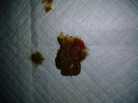 Why Does My Puppy Have Diarrhea With Blood