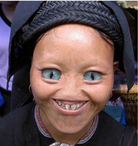 http://www.buzzodd.com/10-most-scary-faces-of-people-from-real-life/ | Odd Things | Pinterest ...