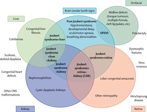 Joubert syndrome: congenital cerebellar ataxia with the molar tooth - The Lancet Neurology