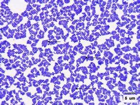 [Figure, Gram Stain of Staphylococcus aureus Contributed by Scott Jones, MD] - StatPearls - NCBI ...