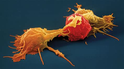 Engineered natural killer cells may be the next great cancer immunotherapy | Science | AAAS