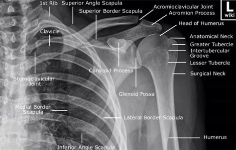 X-ray Vision - Shoulders and Elbows — Taming the SRU | Medical anatomy, Radiology student ...