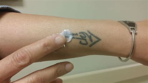 Tattoo Removal Cream: Does It Work? - AuthorityTattoo