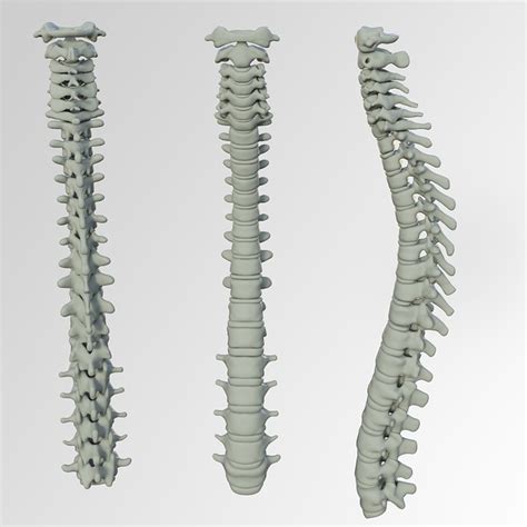 What Is Sclerosis Of The Spine And Is It Treatable