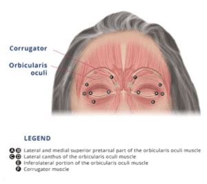 Dosing XEOMIN® | Adults With Blepharospasm