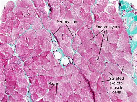 Skeletal Muscle Tissue Histology