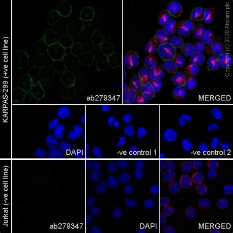 Recombinant Anti-CD30 antibody [SH313-B5] - Chimeric – BSA and Azide ...