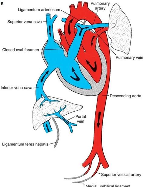 Schematic Diagram Of Fetal Circulation