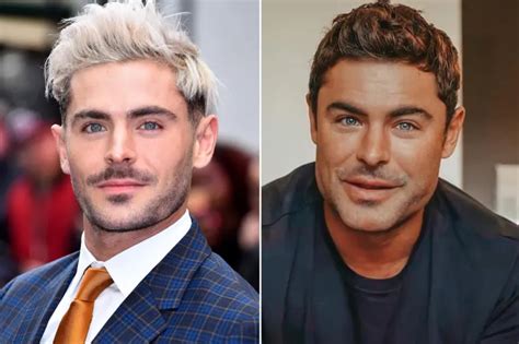 Zac Efron Botox And Jaw Surgery Before And After Surgery