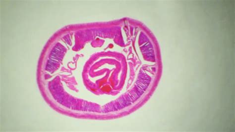 Earthworm Under The Microscope, Background. (Lumbricidae) Stock Footage Video 2933560 - Shutterstock