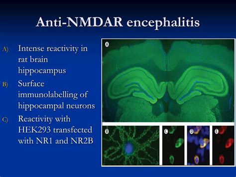 PPT - Anti-NMDAR Encephalitis: The McGill Experience PowerPoint ...