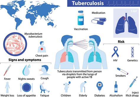 Tuberculosis - DiseasesAndConditions.net