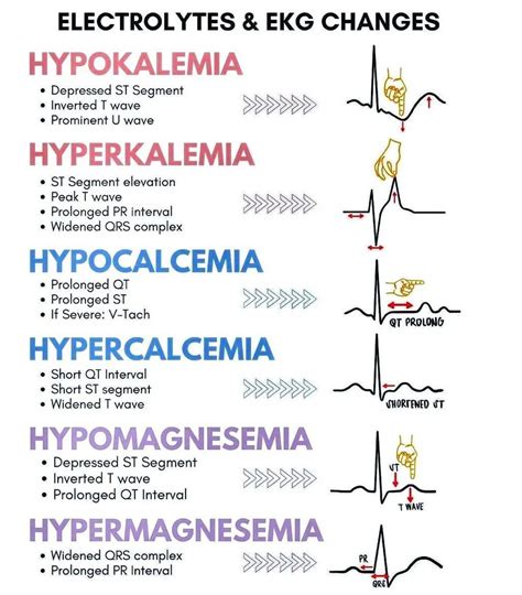 Electrolytes and EKG Changes - MEDizzy