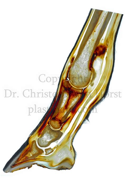 Equine long pastern bone limb fracture - Plastination Anatomy Embedding