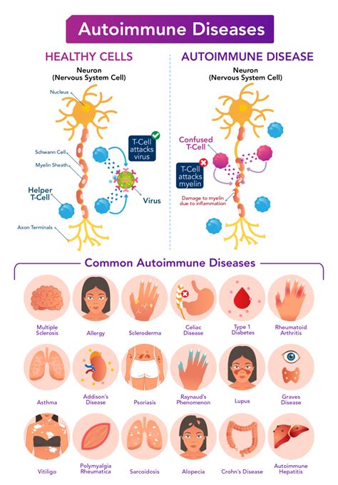 The Immune Response: A Cellular War - Let's Talk Science