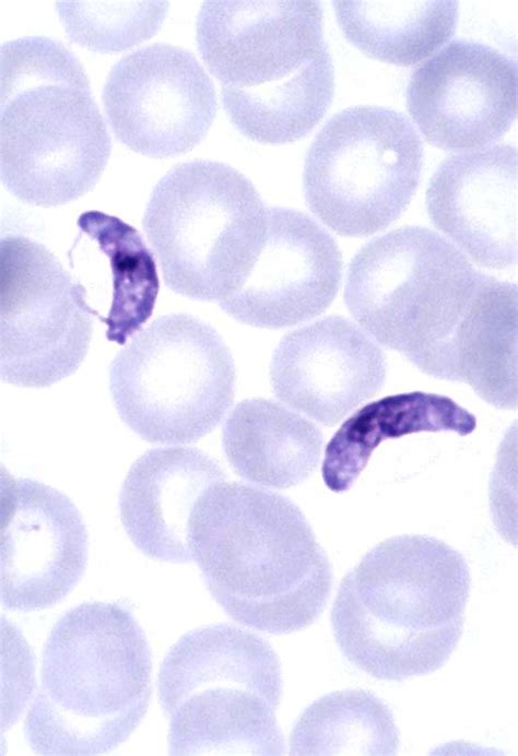 Plasmodium falciparum