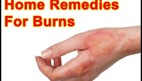 HomeRemedies for Skin Burns | Burnt skin Homeremedies |- Getinfopedia.com