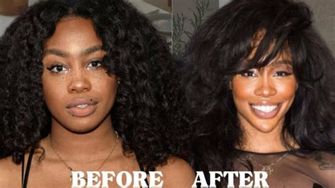 Everything About SZA Before Surgery- A Best Fashion