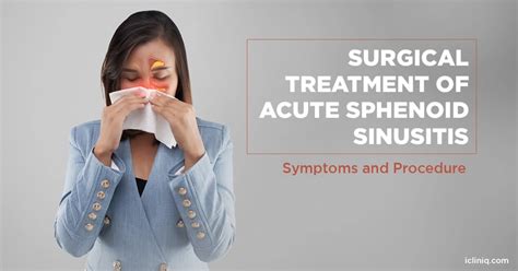 What Is the Surgical Treatment Of Acute Sphenoid Sinusitis?