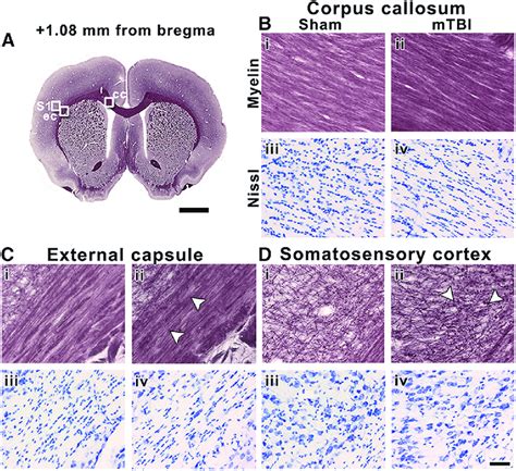 Representative whole-brain myelin-stained section of a sham-operated ...