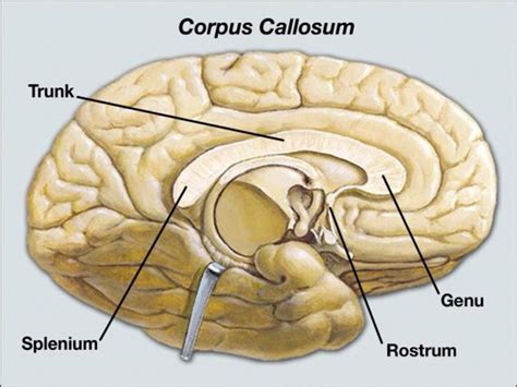 Corpus Callosum : Anatomy, Location & Function | Corpus callosum, Brain anatomy, Brain injury