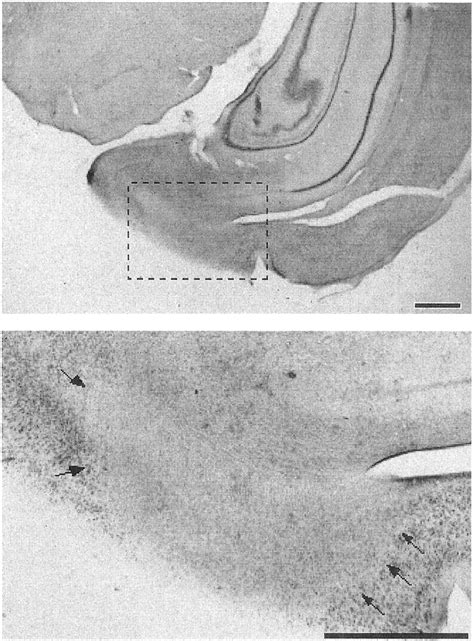 Photomicrographs of a representative lesion of the entorhinal cortex.... | Download Scientific ...