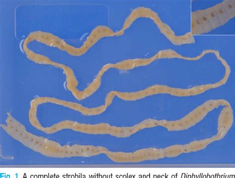 Figure 1 from Diphyllobothrium latum infection in a child with ...