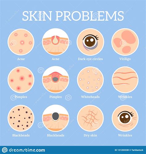 skin-problems-ages-wrinkles-problem-face-skin-infection-treatment-dark-circles-under-eyes-black ...