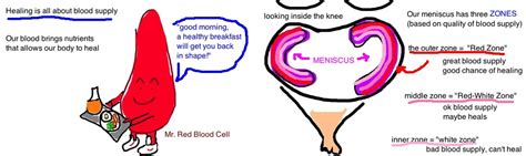 Knee - Meniscus Tear — Bone Talks