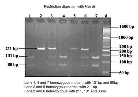 Part 2: Analysing and Interpreting (Agarose) Gel Electrophoresis Results