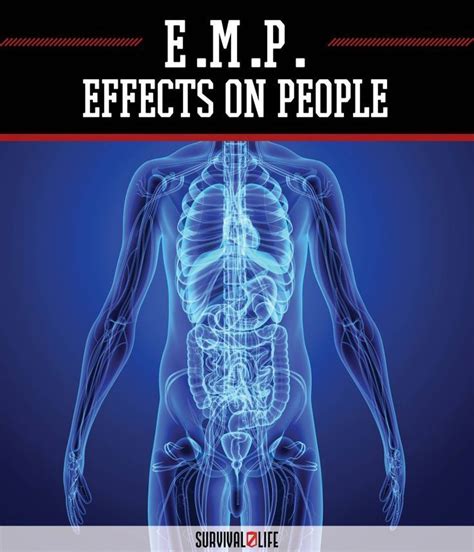 What are the Effects of EMP on People (With images) | Survival life, Survival prepping, Survival