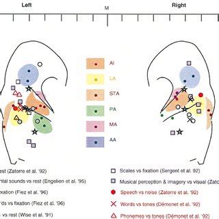 1 Primary auditory cortex (A1) and five areas of non-primary auditory... | Download Scientific ...