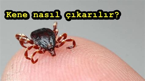 Kene nasıl çıkarılır? Zararsız kene nasıl anlaşılır? Kene zehirlenmesi kaç saatte belli olur ...