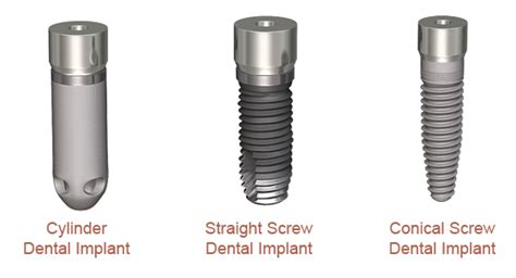 Dental Implant Types