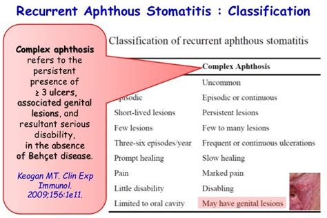 Recurrent aphthous stomatitis