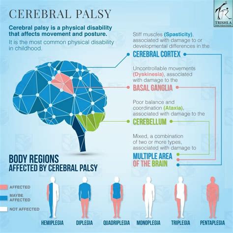 Cerebral Palsy Complete Guide by Trishla Foundation