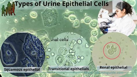 Transitional Epithelial Cells In Urine, 60% OFF