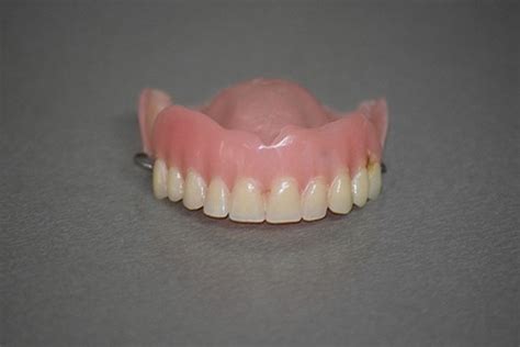 Dentures Alternatives - Alternative Options For Dentures